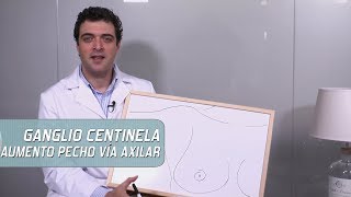 Ganglio centinela y aumento de pecho vía axilar [upl. by Eamon]