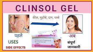 Clinsol gel for pimples  Acne  clinsol gel ke fayade and nukshan [upl. by Rinum]