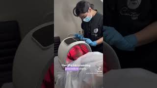 Microneedling  Led Therapy in Dubai microneedling dubai abudhabi ledtherapy bbglowdubai [upl. by Nicolas]