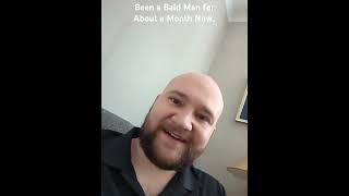 Been a Bald Man for a Month Now [upl. by Menard795]