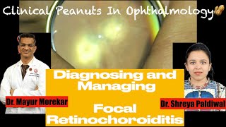 Toxoplasma RetinochoroiditisCase discussion for Ophthalmologists Residents trainees and students [upl. by Airakaz954]