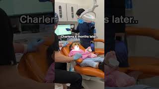 Highly observant child remembers instructions TOO well 😂 Pediatric Dentist [upl. by Lenuahs]