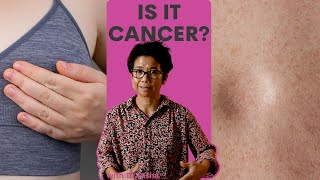 Are All Breast Lumps Cancer With Dr Tasha [upl. by Aipotu]