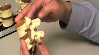 Degenerative Disc Disease Basic Terminology  Disc Herniations Osteophytes Stenosis [upl. by Barthel]