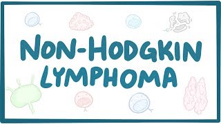 Nonhodgkin lymphoma  causes symptoms diagnosis treatment pathology [upl. by Isolt]