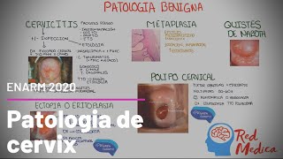 Cancer cervicouterino CaCU cervicitis y otra patología de cervix ENARM [upl. by Ayikaz]