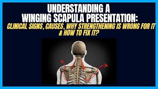 Winging Scapula Clinical Presentations amp Why It Isn’t A Serratus Anterior Problem [upl. by Gnof253]