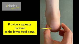 Squeeze Test for Severs Heel Pain [upl. by Boyden52]