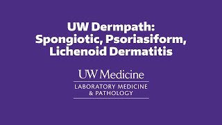 UW Dermpath Spongiotic Psoriasiform Lichenoid Dermatitis [upl. by Ayatan]