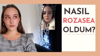 ROZASEA NEDİR  BENİM BAŞIMA NASIL GELDİ ROZASEADOSYASI 1 [upl. by Ardnassac]