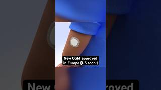 Simplera CGM from Medtronic receives CE Mark in Europe [upl. by Shriner205]