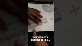 Cephalometric analysis detectivework orthodontics smile subscribe credits comment antropology [upl. by Arsi]