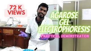 Agarose gel electrophoresis [upl. by Anaeed39]