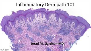 Inflammatory Dermpath 101 A Beginners Guide to Diagnosing Skin Rashes for NonDermatopathologists [upl. by Schoof802]