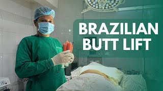 Brazilian Butt Lift  BBL  Buttock Enlargement  Butt Lift  Fat Transfer  Body Shaping [upl. by Fujio]