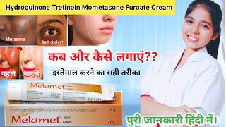 Hydroquinone tretinoin mometasone furoate cream  Melamet Cream Ki Jankari  Drx Pranjali Satpute [upl. by Fiel736]