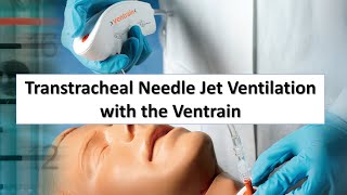 Transtracheal Needle Jet Ventilation TTJV with the Ventrain [upl. by Adlin722]