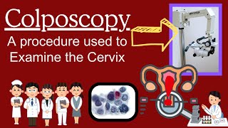 What is Colposcopy Explained for cervical screening and Cervical Biopsy FOR Cancers and HPVs [upl. by Netsirk]