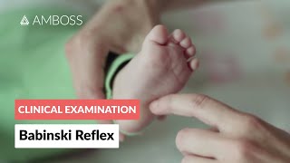 Babinski Reflex in Infants  Clinical Examination [upl. by Linzy]