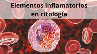 Elementos inflamatorios en citología Glóbulos blancos Leucocitos [upl. by Adehsor]