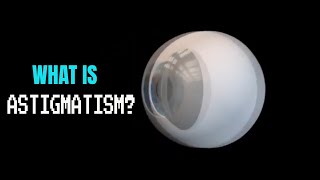 Astigmatism explained [upl. by Jeunesse688]