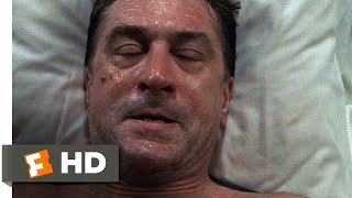 Ronin 79 Movie CLIP  Sams Surgery 1998 HD [upl. by Llerred]