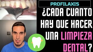 ¿CADA CUANTO hay que realizarse una LIMPIEZA DENTAL  Profilaxis bucal [upl. by Samale]