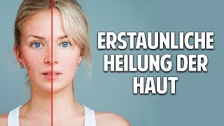 Probleme mit der Haut Erstaunliche Heilung durch natürliche Kosmetik [upl. by Jamal]