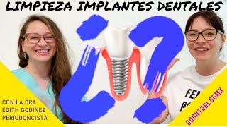 LIMPIEZA DE IMPLANTES DENTALES 🦷 con Dra Edith Godínez Padilla [upl. by Ahsimal]