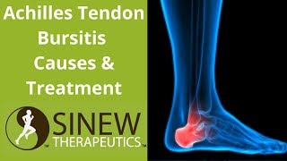 Achilles Tendon Bursitis Causes and Treatment [upl. by Anot]