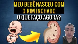 HIDRONEFROSE PÓS NATAL meu bebê nasceu com o rim inchado O que faço agora  Parte 2 [upl. by Anoek196]