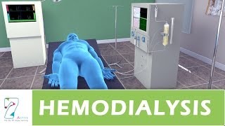 Hemodialysis [upl. by Garibald]