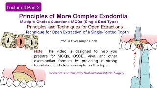 Lecture 4 Part2 MCQs  Open Extraction of Single Rooted Tooth  MultipleChoice Questions [upl. by Ynittirb]