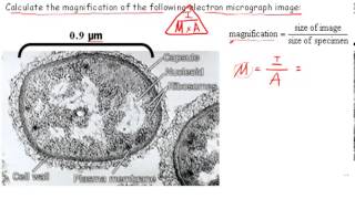 Calculating Magnification IB Biology [upl. by Sachi]