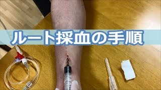 ルート採血 How to take a blood sample with IV catheter [upl. by Uticas]