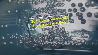 Nonlactose fermenting Escherichia coli growth on CLED Agar [upl. by Rob]