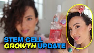 Stem Cell Hair Growth Update Calecim UPDATE on My Hair Loss [upl. by Aneis688]