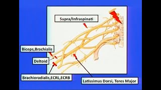 Brachial Plexus Injuries [upl. by Pall]