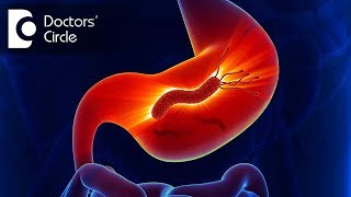 Is medical management for H pylori infection effective  Dr Sanjay Panicker [upl. by Murtagh183]