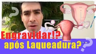 Fiz Laqueadura e quero engravidar Reversão de Laqueadura ou FIVFertilização in vitro Qual é me [upl. by Jaye]