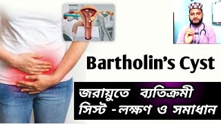 মেয়েদের তলপেটে তীব্র ব্যথা কেন হয়what is bartholin cyst birthlines abscess homeopathic treatment [upl. by Artemas365]