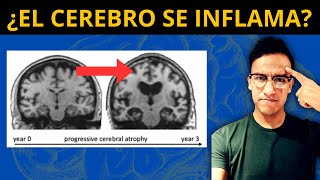 ¿EL CEREBRO SE INFLAMA Neuroinflamación nutrición y probióticos [upl. by Benjie184]