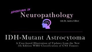 IDH  Mutant Astrocytoma Update from the 5th Edition WHO Classification of CNS Tumors [upl. by Eenet646]