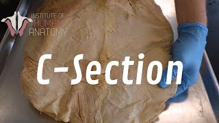 The Anatomy of a CSection [upl. by Odelinda]