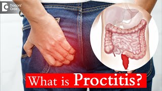 Proctitis Causes Treatment and Surgery  Dr Rajasekhar M R  Doctors Circle [upl. by Luigi]