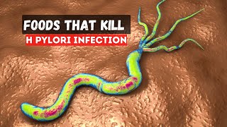 5 Foods That Kill H Pylori Infection [upl. by Elletnohs944]