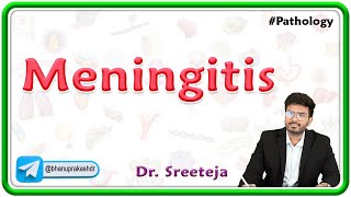 4 Meningitis  USMLE Step 1 Pathology [upl. by Bihas565]