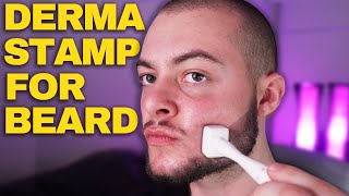 How To Derma Stamp Beard Properly Derma Stamp Tutorial Minoxidil amp Derma Stamp [upl. by Rawley]