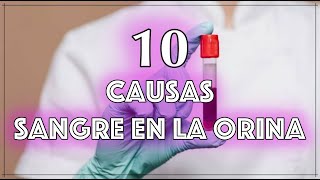 Sangre en la Orina Descubre las 10 Causas Principales y Qué Hacer al Respecto [upl. by Coreen]