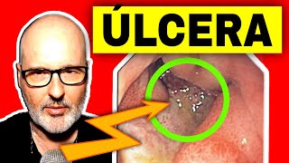 ÚLCERA GÁSTRICA o DUODENAL Síntomas Causas y Tratamiento [upl. by Htiekel910]